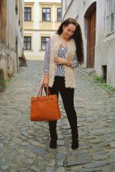 (OOTD) Stripes & Fur vest