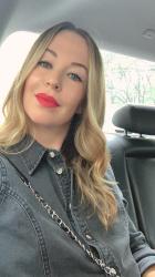 My Fraxel Laser Treatment Experience + a Photo Diary