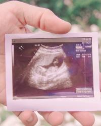 A baby girl is on the way!!