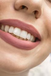 Love Yourself: Pep Talk About Dental Work