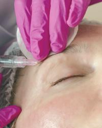5 Top-Rated Plastic Surgeons in Toronto for Facial Rejuvenation